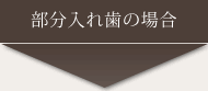 部分入れ歯の場合