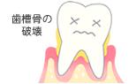 歯槽骨の破壊